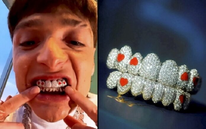 Rapper Wears $50,000 Diamonds on His Teeth